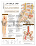 Understanding Low Back Pain Anatomical Chart